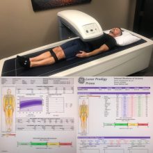 what is a dexa scan
